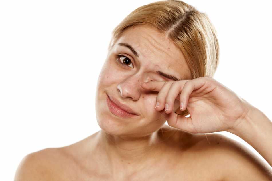 Corneal Abrasions Causes, Symptoms and Treatment