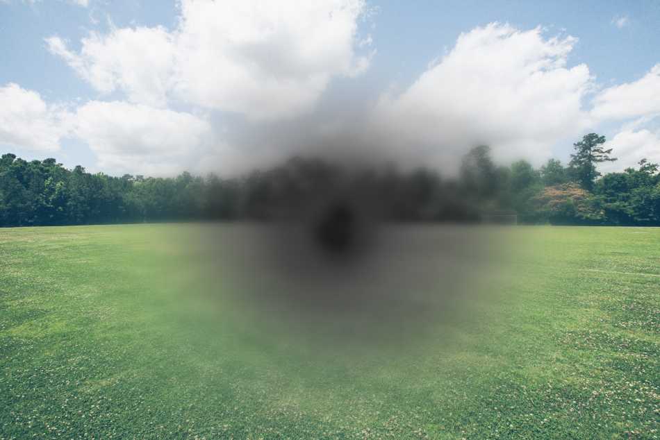 Understanding Macular Degeneration: Types, Risks, Diagnosis, and Treatment