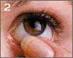 REmoving Contact Lenses
